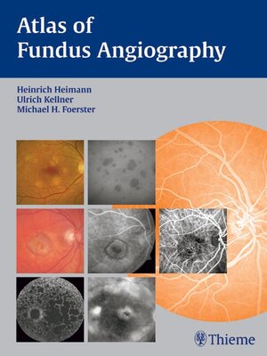 cover image of Atlas of Fundus Angiography